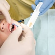 A child lies in a dental chair while a dentist applies fluoride treatment to their teeth using a small brush.