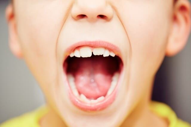 Trying To Get The Picture Straight: Are Your Child’s Teeth Crooked?